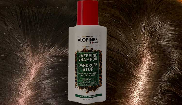 Alopinex Dandruff Stop Shampoo For Oily Dandruff 