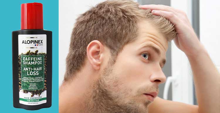 Alopinex Anti Hair Loss Shampoo For Oily Hair